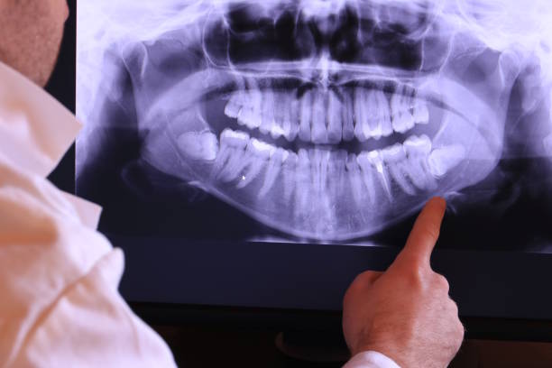 Best Emergency Treatment for Oral Infections in Laguna Beach, FL