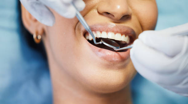 Best Broken or Chipped Tooth Repair in Laguna Beach, FL