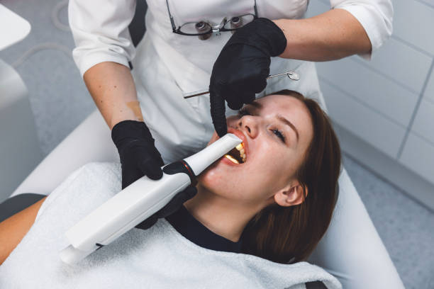 Best Knocked-Out Tooth (Avulsed Tooth) Treatment in Laguna Beach, FL
